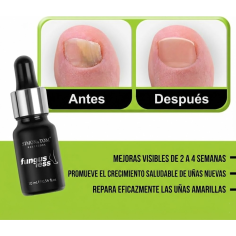 Fungusless: tratamiento natural y regenerador de uñas 2