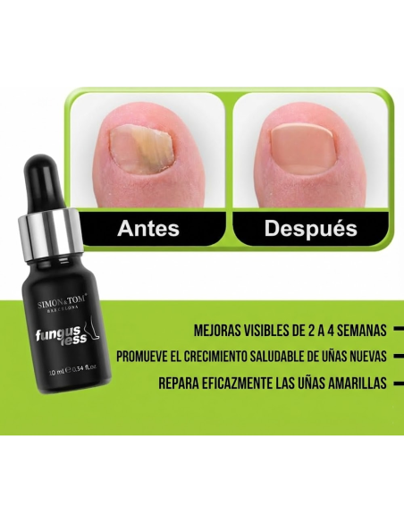 Tratamiento de Uñas FUNGUSLESS