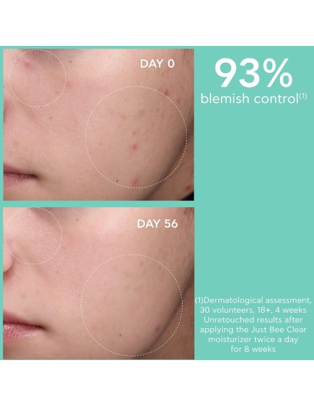 APIVITA JUST BEE CLEAR - Crema Anti-Imperfecciones Matificante Hidratante.