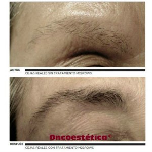 fortalecedor de cejas